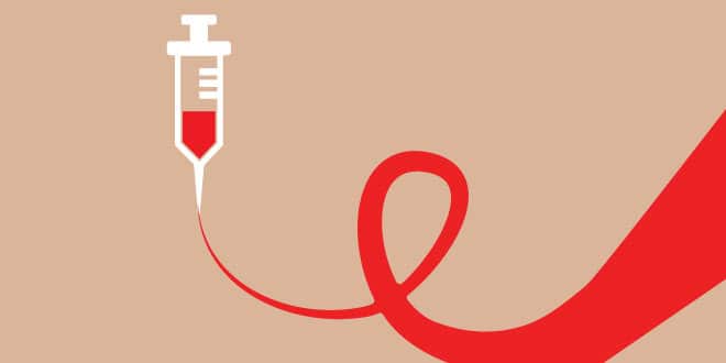HIV AIDS