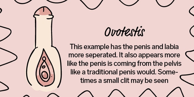 intersex